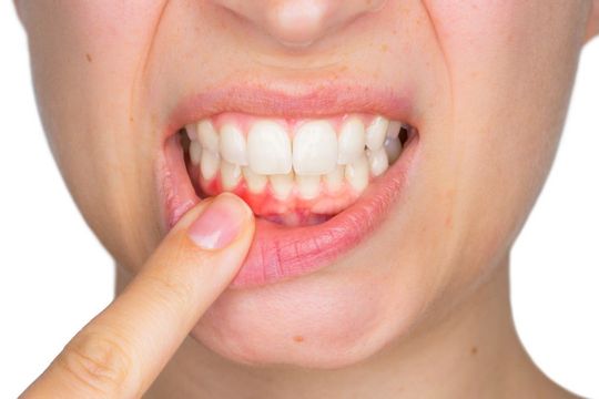 7 dấu hiệu răng miệng mà bạn không được chủ quan!