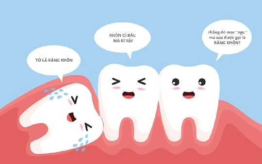 #4 điều cần biết trước khi điều trị răng khôn