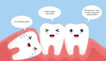 #4 điều cần biết trước khi điều trị răng khôn