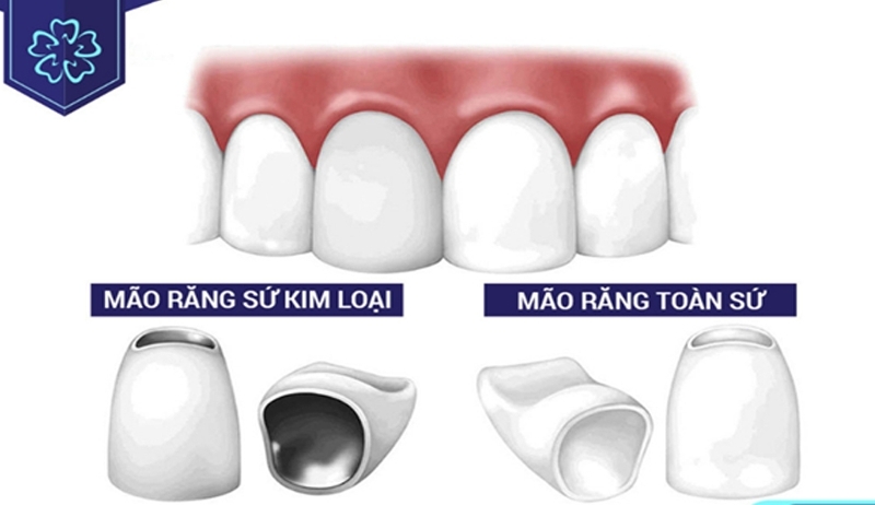 Lựa chọn cao cấp, chất lượng hơn