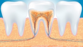 Điều trị nội nha một lần hẹn?